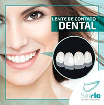 Lentes de Contato Dental. Clínica Sorrio. DentistasRio.com.br